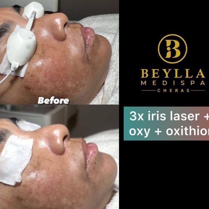 beylla medispa kuala selangor